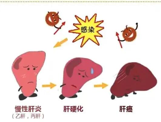 91免费看视频下载厂家提醒肝脏疾病治不好？要了解是否含铁食物摄入多
